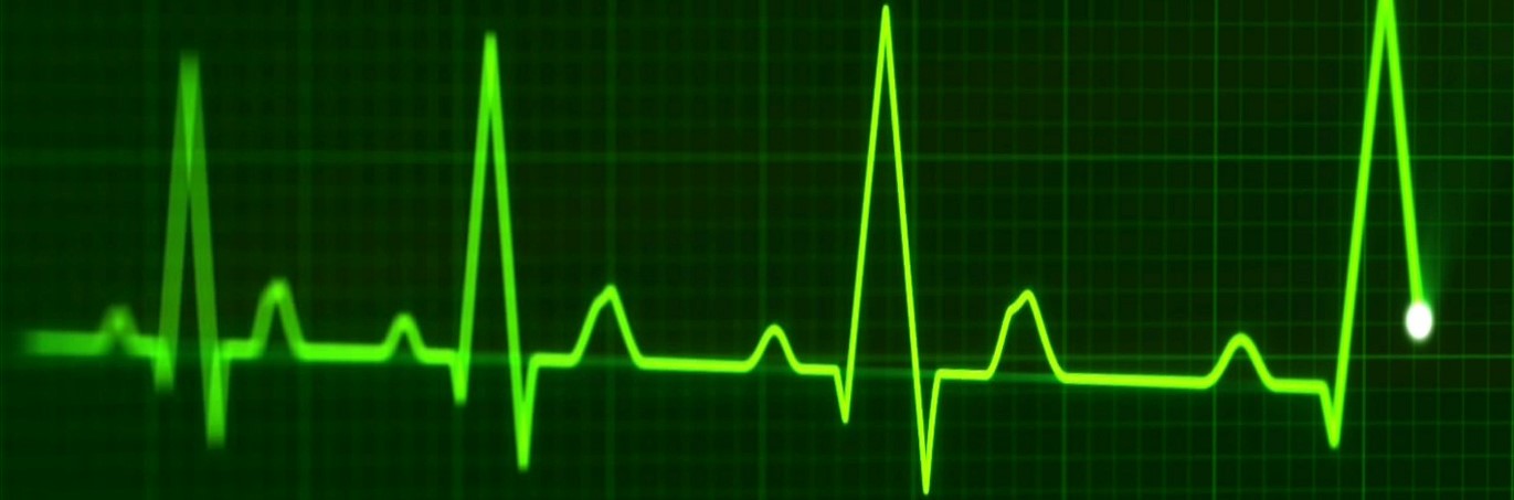 green heart rate monitor chart